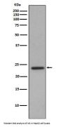 Anti-Id1 Rabbit Monoclonal Antibody