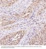 Anti-Hsp70 HSPA1A Rabbit Monoclonal Antibody