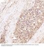 Anti-Hsp70 HSPA1A Rabbit Monoclonal Antibody