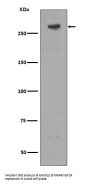 Anti-M6PR IGF2R Rabbit Monoclonal Antibody