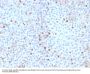 Anti-Topoisomerase II alpha (Proliferation & Drug-Resistance Marker) Monoclonal Antibody
