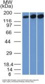 Anti-Topoisomerase II alpha (Proliferation & Drug-Resistance Marker) Monoclonal Antibody