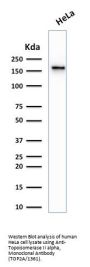 Anti-Topoisomerase II alpha (Proliferation & Drug-Resistance Marker) Monoclonal Antibody