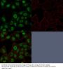 Anti-Topoisomerase II alpha (Proliferation & Drug-Resistance Marker) Monoclonal Antibody