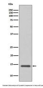 Anti-Cystatin C CST3 Rabbit Monoclonal Antibody