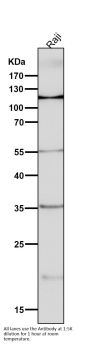 Anti-NFAT1 NFATC2 Rabbit Monoclonal Antibody