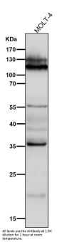 Anti-NFAT1 NFATC2 Rabbit Monoclonal Antibody