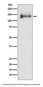 Anti-HDAC4/Histone Deacetylase 4 Rabbit Monoclonal Antibody