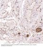 Anti-S100B/S100 Beta Rabbit Monoclonal Antibody