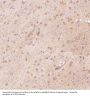Anti-S100B/S100 Beta Rabbit Monoclonal Antibody
