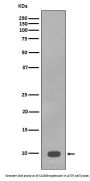 Anti-S100B/S100 Beta Rabbit Monoclonal Antibody