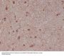 Anti-S100B/S100 Beta Rabbit Monoclonal Antibody