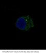 Anti-S100B/S100 Beta Rabbit Monoclonal Antibody