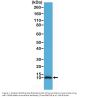 Anti-S100-beta Rabbit Monoclonal Antibody, Clone#RM304