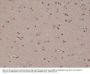 Anti-S100-beta Rabbit Monoclonal Antibody, Clone#RM304
