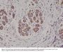 Anti-S100-beta Rabbit Monoclonal Antibody, Clone#RM304