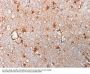 Anti-S100B (Astrocyte and Melanoma Marker) Monoclonal Antibody