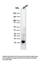 Anti-S100B (Astrocyte and Melanoma Marker) Monoclonal Antibody
