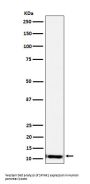 Anti-SPINK1 Rabbit Monoclonal Antibody