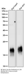 Anti-Caveolin-3 CAV3 Rabbit Monoclonal Antibody