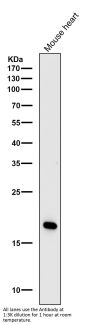 Anti-Caveolin-3 Rabbit Monoclonal Antibody