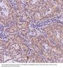 Anti-AMPK alpha 1 PRKAA1 Rabbit Monoclonal Antibody