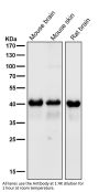 Anti-TDP43 TARDBP Rabbit Monoclonal Antibody