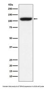 Anti-TRPM8 Monoclonal Antibody