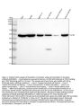 Anti-Neurokinin 1 Receptor Monoclonal Antibody