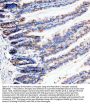 Anti-Neurokinin 1 Receptor Monoclonal Antibody