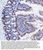 Anti-Neurokinin 1 Receptor Monoclonal Antibody