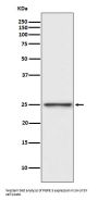 Anti-PGP9.5 Rabbit Monoclonal Antibody
