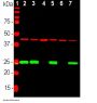 Anti-Ubiquitin C-Terminal Hydrolase 1 (UCHL1) Antibody