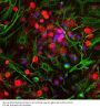 Anti-Ubiquitin C-Terminal Hydrolase 1 (UCHL1) Antibody