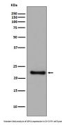 Anti-GPX1/Glutathione Peroxidase 1 Rabbit Monoclonal Antibody
