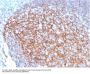Anti-CD35 / CR1 (Follicular Dendritic Cell Marker) Monoclonal Antibody