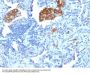 Anti-CD209 / DC-SIGN (Pathogen Receptor on Dendritic Cells) Monoclonal Antibody