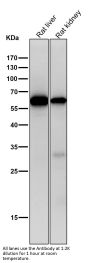 Anti-Collagen X COL10A1 Rabbit Monoclonal Antibody