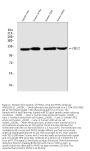Anti-PMS2 Rabbit Monoclonal Antibody