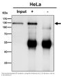 Anti-PMS2 Rabbit Monoclonal Antibody