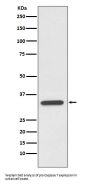 Anti-pro Caspase 7 CASP7 Rabbit Monoclonal Antibody