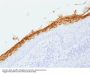 Anti-Filaggrin (Keratinocyte Differentiation Marker) FLG Monoclonal Antibody