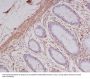 Anti-alpha smooth muscle Actin ACTA2 Rabbit Monoclonal Antibody