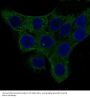 Anti-alpha smooth muscle Actin ACTA2 Rabbit Monoclonal Antibody