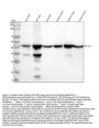 Anti-alpha smooth muscle Actin ACTA2 Rabbit Monoclonal Antibody