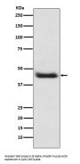 Anti-alpha smooth muscle Actin ACTA2 Rabbit Monoclonal Antibody