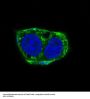 Anti-alpha smooth muscle Actin ACTA2 Rabbit Monoclonal Antibody