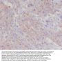 Anti-alpha smooth muscle Actin ACTA2 Rabbit Monoclonal Antibody