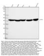 Anti-alpha smooth muscle Actin ACTA2 Rabbit Monoclonal Antibody