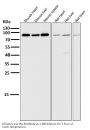 Anti-STAT5A/B Rabbit Monoclonal Antibody